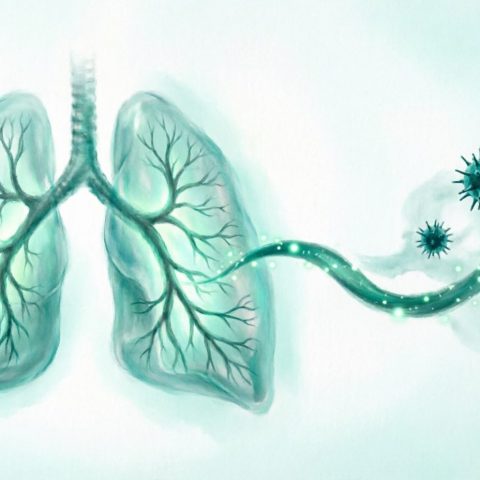 Пневмония: причины, симптомы, диагностика и лечение